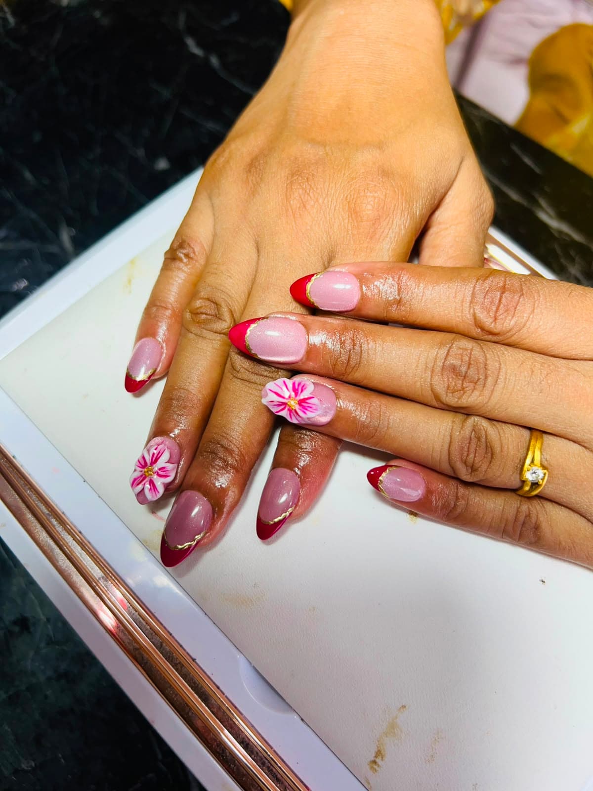 Nail Removal